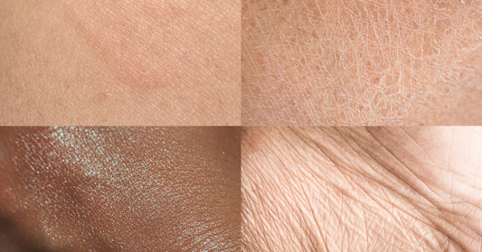 How to Define Your Skin Type: A Beginner's Guide